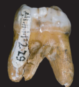 The Denisovan tooth